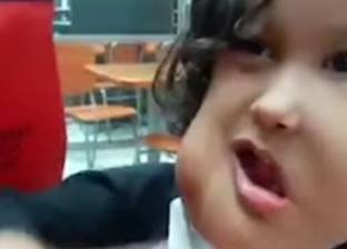 بالفيديو| طفل مكسيكي يعاني من أورام هائلة في الوجه.. يصفونه بـ"الوحش"