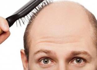 "وداعا للصلع".. علماء يطورون طريقة جديدة لاستنبات الشعر