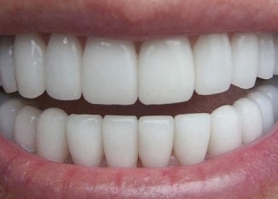 تعرف على فوائد الغذاء للأسنان: العرقسوس مضاد للتسوس