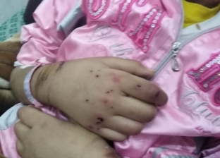 تفاصيل تعذيب طفلة على يد أمها بالإسماعيلية: أرادات الانتقام من طليقها