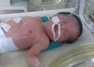 صور| مأساة الطفل "مروان".. وُلد بدون مخ ويحتاج إلى جراحتين دقيقتين