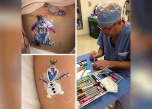 طبيب يمنح الأطفال بعد عمليات الجراحة ضمادات رسم عليها شخصيات ديزني