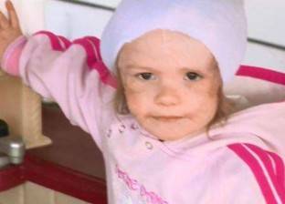 بالصور| طفلة 3 سنوات تفقد أذنها بعد هجوم كلب مفترس عليها