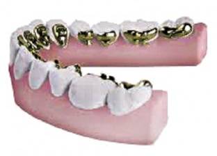 تقويم أسنان من الذهب «عيار 24»: فى فمى «كنز»
