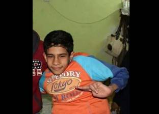 بالصور| مأساة الطفل "محمد".. جسد نحيل أثقله ورم "الفقر والسرطان"