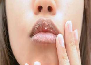 جفاف الفم بعد علاج السرطان.. نصائح للتخفيف من هذا التأثير الجانبي