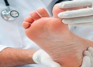 مواصفات الحذاء المناسب لمريض القدم السكري.. مريح ويمنع الألم