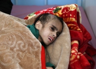«جلد على عضم».. صور صادمة لطفل يمني يعاني «الجوع»: وزنه 7 كيلو