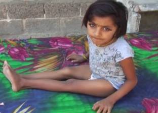 بالفيديو| طفلة مريضة بـ"هشاشة العظام" تعرضت لكسور 14 مرة