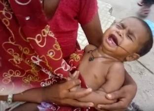 بالفيديو| لقطات مرعبة لرضيعة اخترق فمها سيخ حديد