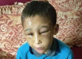 مفاجآت في قضية الطفل مصطفى ضحية التعذيب: أبوه وأمه رد سجون
