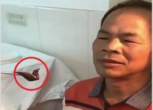 بالفيديو| لحظة استخراج "علقة" عاشت أسبوعين في أنف رجل صيني
