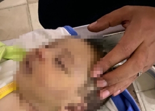 7 مشاهد من حادثة  قتل كلب ضال لطفل رضيع داخل غرفته