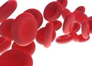بشري لمرضي لوكيميا الدم الليمفاوي المزمن.. اختبار جديد يتنبأ بنوع المرض لتحديد العلاج لكل حالة