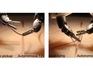 روبوت يجري عملية جراحية بمهارة الطبيب.. هل يساهم في إنقاذ حياة المرضى؟