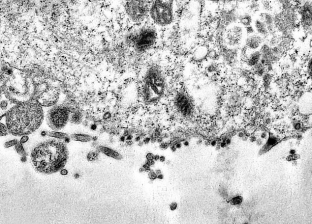 صور "مكبرة 2 مليون مرة".. لحظة اختراق فيروس كورونا الخلايا الحية
