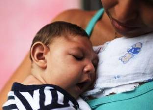 دراسة: صغر حجم الرأس لدى أطفال "زيكا" يأتي بعد الولادة