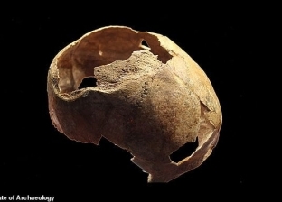 جمجمة تكشف عن عملية جراحية فاشلة قبل 5 آلاف عام: أجريت بمشرط حجري (صور)