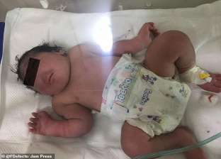 بالصور| حالة نادرة.. ولادة طفل دون أنف في العراق