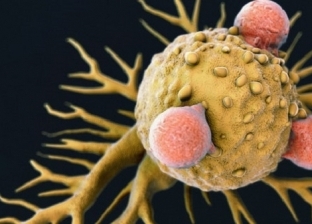 يعالج جميع أنواع السرطان.. معلومات عن العلاج الجديد T-CELL