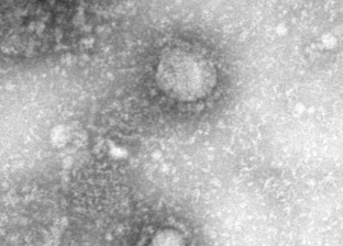 باحثون: فيروس كورونا تحور لسلالة جديدة أسرع انتشارا