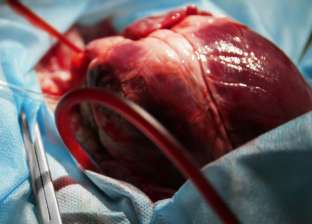 استشاري جراحة: هناك تقنية حديثة أفضل من القلب المفتوح وهي القلب النابض