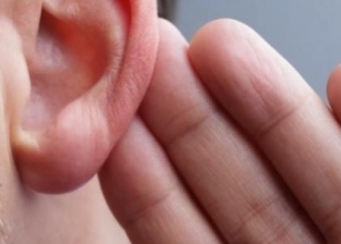 أستاذ بـ"طب الزقازيق": متوقع إصابة مليار شخص بضعف السمع بحلول 2050