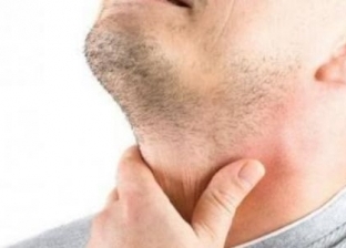 أسباب الإصابة بقصور الغدة الدرقية وكيفية العلاج: انتبه لانتفاخ الوجه