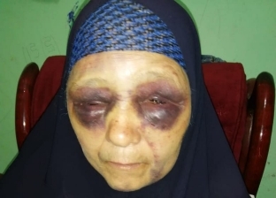 سيدة كفر الشيخ المطرودة من منزلها تتهم ابنها بضربها في محضر رسمي