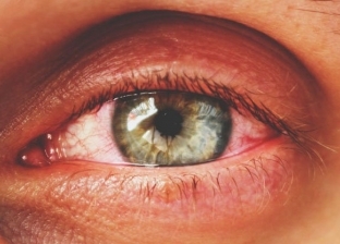 "موجودة بقالها كتير".. العثور على بكتيريا في العين تحميها من العمى