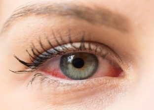 5 طرق للحفاظ على العين عند استخدام الهاتف.. احذر فقدان البصر