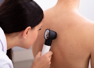 طبيب جلدية يوضح أبرز أمراض الجلد بسبب ارتفاع درجات الحرارة