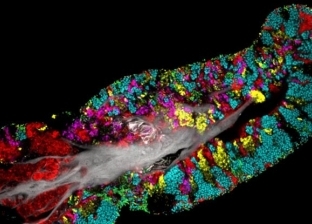 أكثر من 700 نوع.. صور مذهلة تكشف كيف تعيش البكتيريا على لسان الإنسان