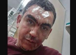 شرطة السعودية تتحرك لضبط المعتدين على طبيب مصري: «ضربوه بخشبة» (فيديو)
