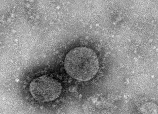 لبنان يعلن تسجيل رابع حالة إصابة بفيروس كورونا المستجد