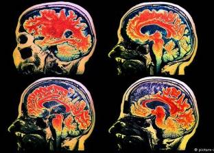 عالم ألماني: مخ الإنسان يمكن تدريبه كأي عضلة بالجسم