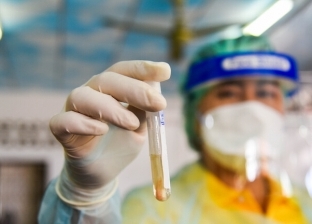 روسيا تعلن بدء المرحلة الأخيرة من التجارب السريرية للقاح فيروس كورونا