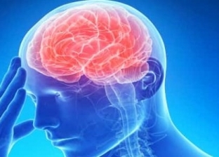 كل ما تريد معرفته عن «السكتة الدماغية».. الأعراض والأسباب والمضاعفات