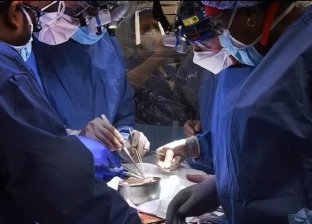 أطباء ينجحون في زراعة قلب خنزير بجسم إنسان.. أول عملية من نوعها
