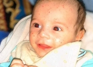الطفل المخطوف من مستشفى أبو الريش في حضن أسرته.. وملاحقات للخاطفة