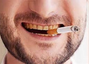 أضرار التدخين على الأسنان.. من أبرزها حدوث سرطان في الفم
