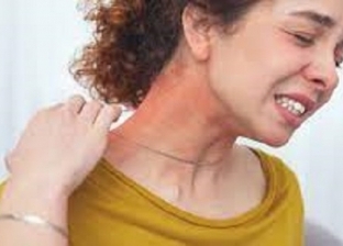 أعراض حساسية الشمس للوقاية من الطفح الجلدي والحكة القوية