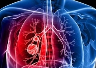 «صحة الشرقية» تحذر: التدخين العامل الأول المسبب لسرطان الرئة