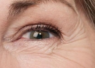 تعرف على أسباب ظهور تجاعيد تحت العين في سن صغيرة وطرق العلاج