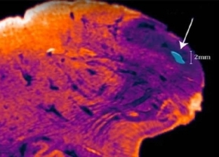 علماء يكتشفون "جسم غامض" في دماغ البشر