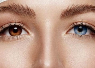 دراسة حديثة: لون العين وسيلة لتحديد الأمراض