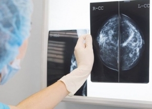 تفوقت على الأطباء.. تقنية حديثة تساعد في تشخيص سرطان الثدي