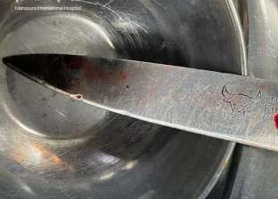 استخراج سكين مطبخ من تجويف صدر طفلة في الدقهلية