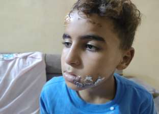 «سيف» الطفل الناجي من حادث دهس في بورسعيد: «كنا قاعدين بناكل حلاوة»
