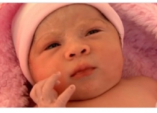بالفيديو| ولادة طفلة "حامل" بجنين